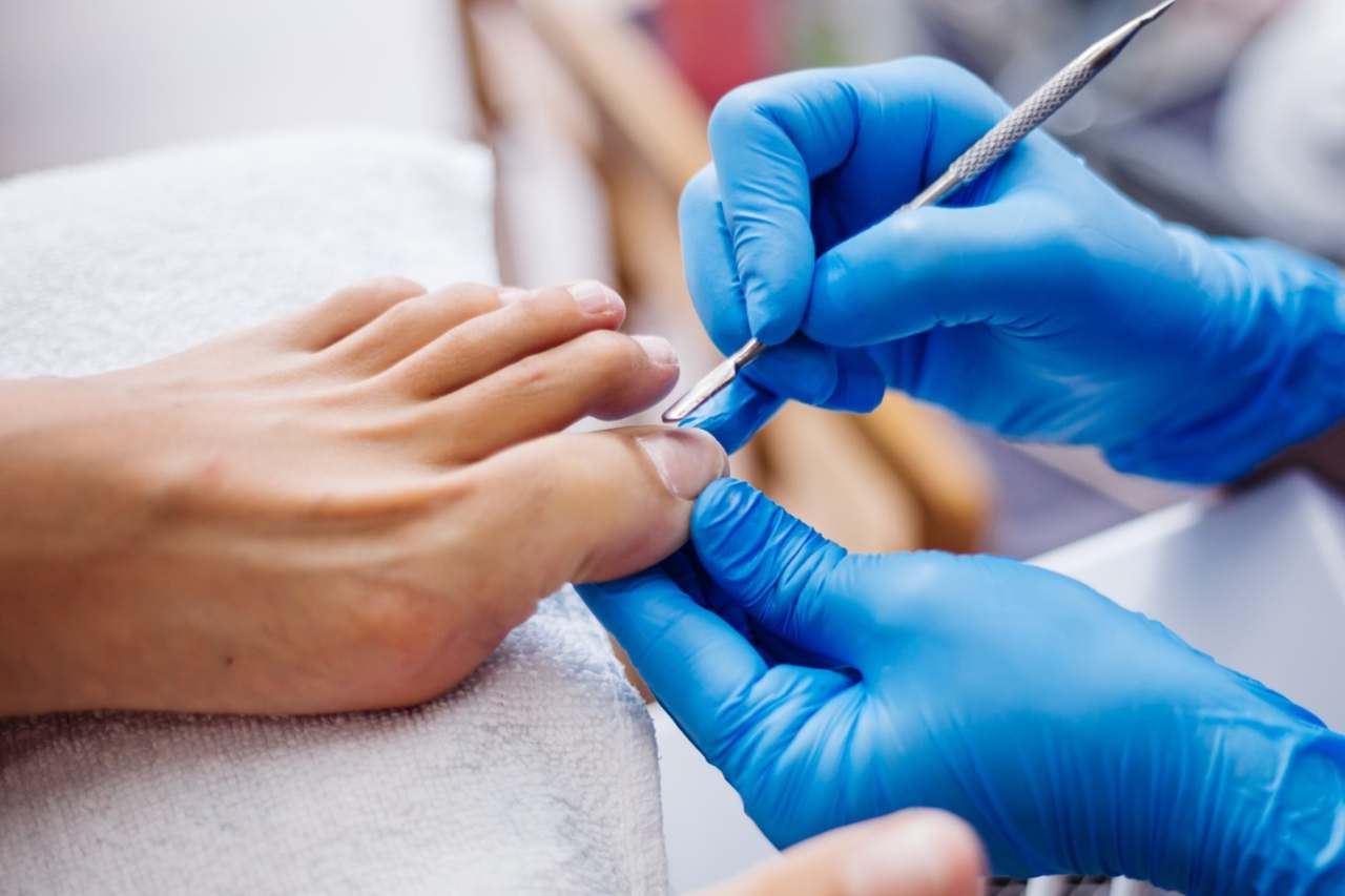 Nail and foot care
