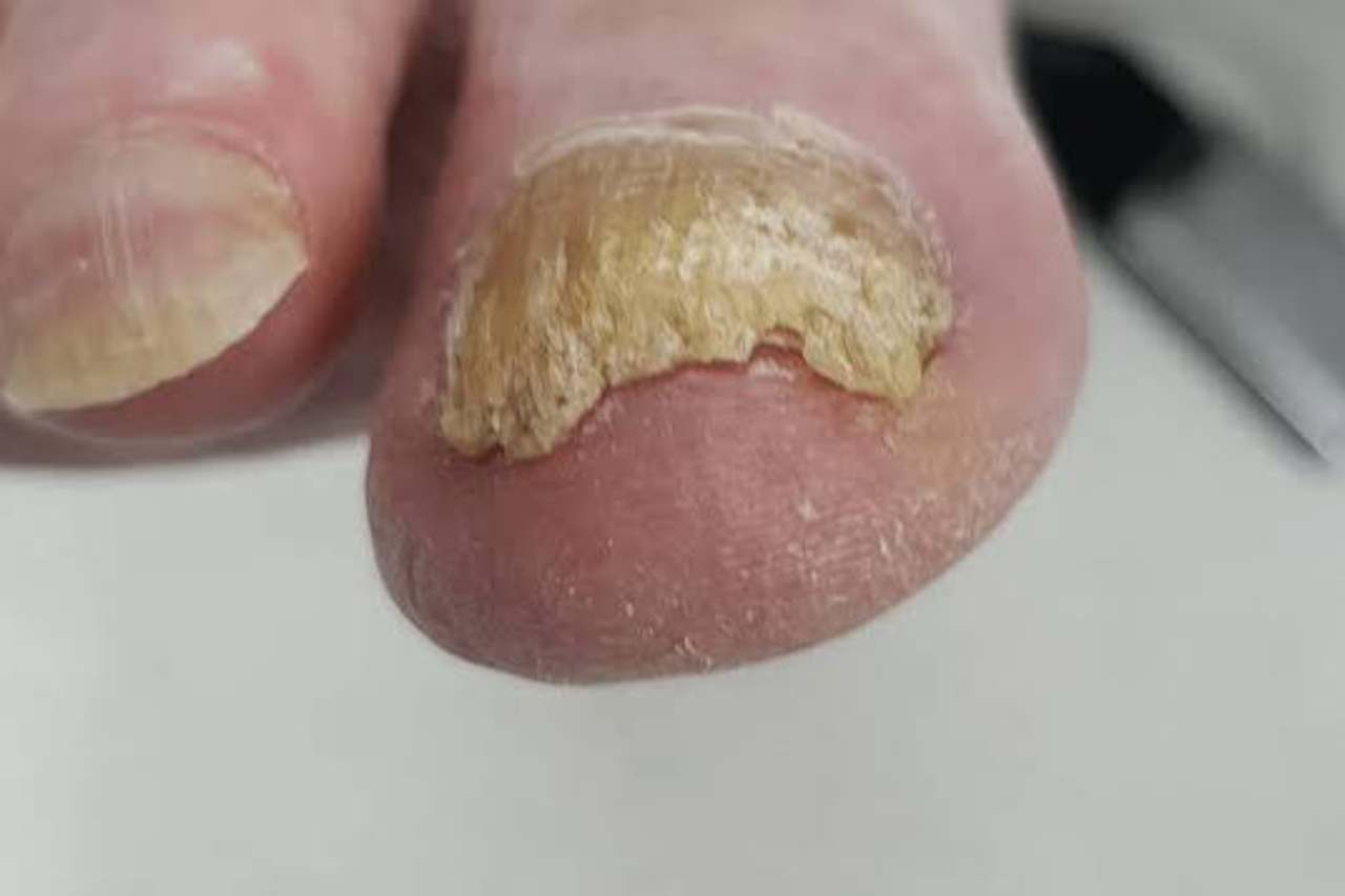 Nail and foot care