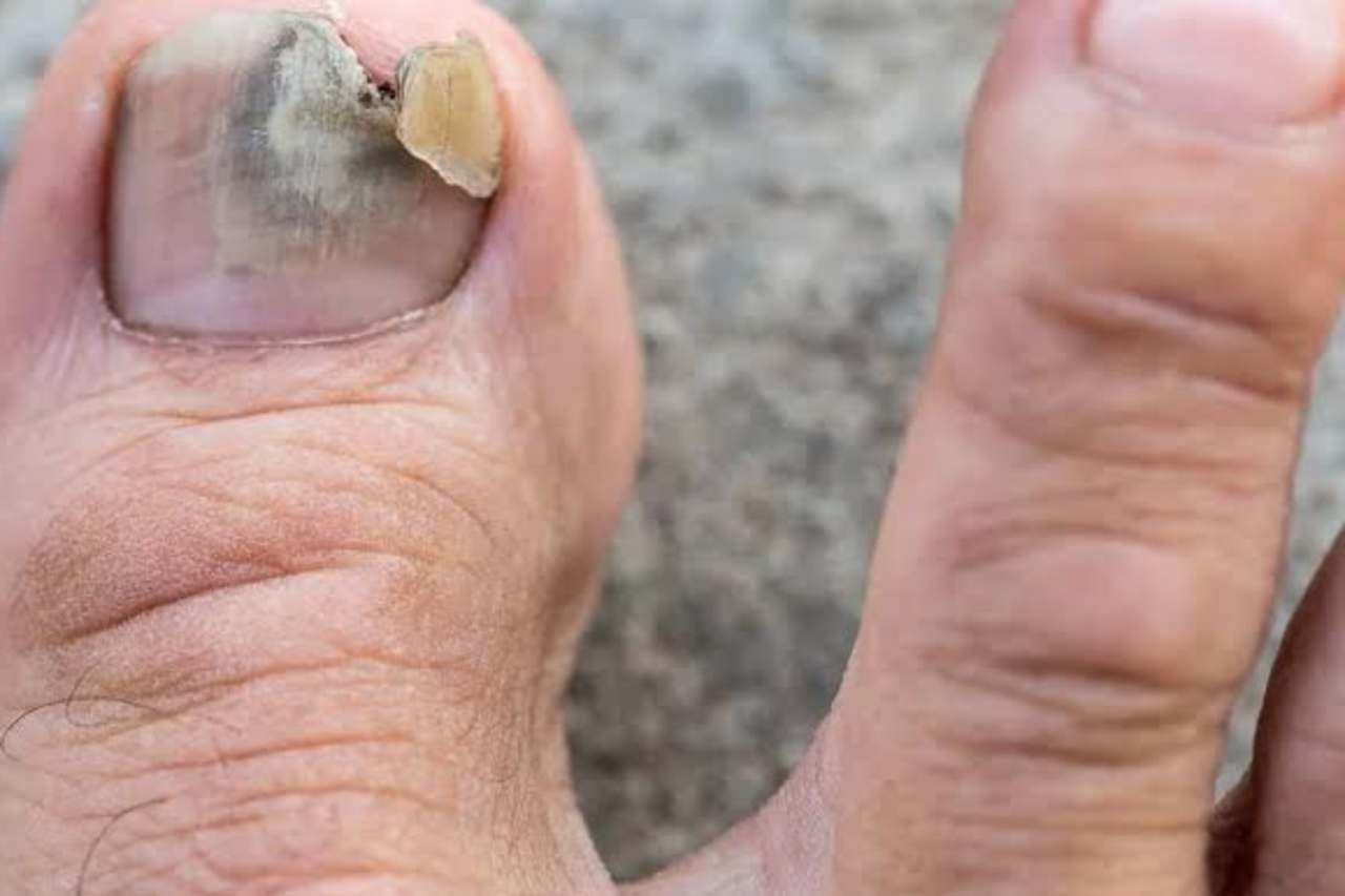 Nail and foot care