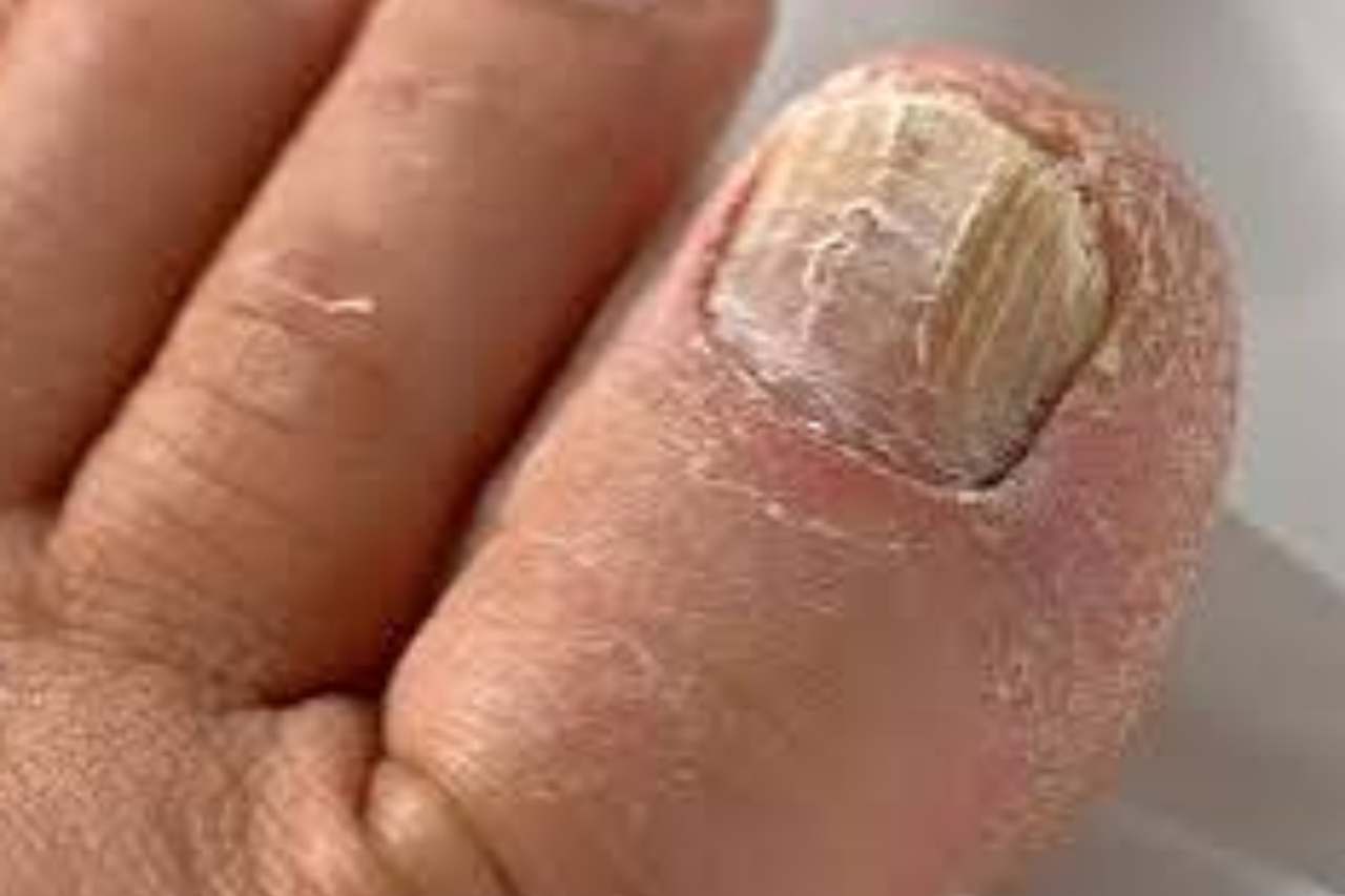 Nail and foot care