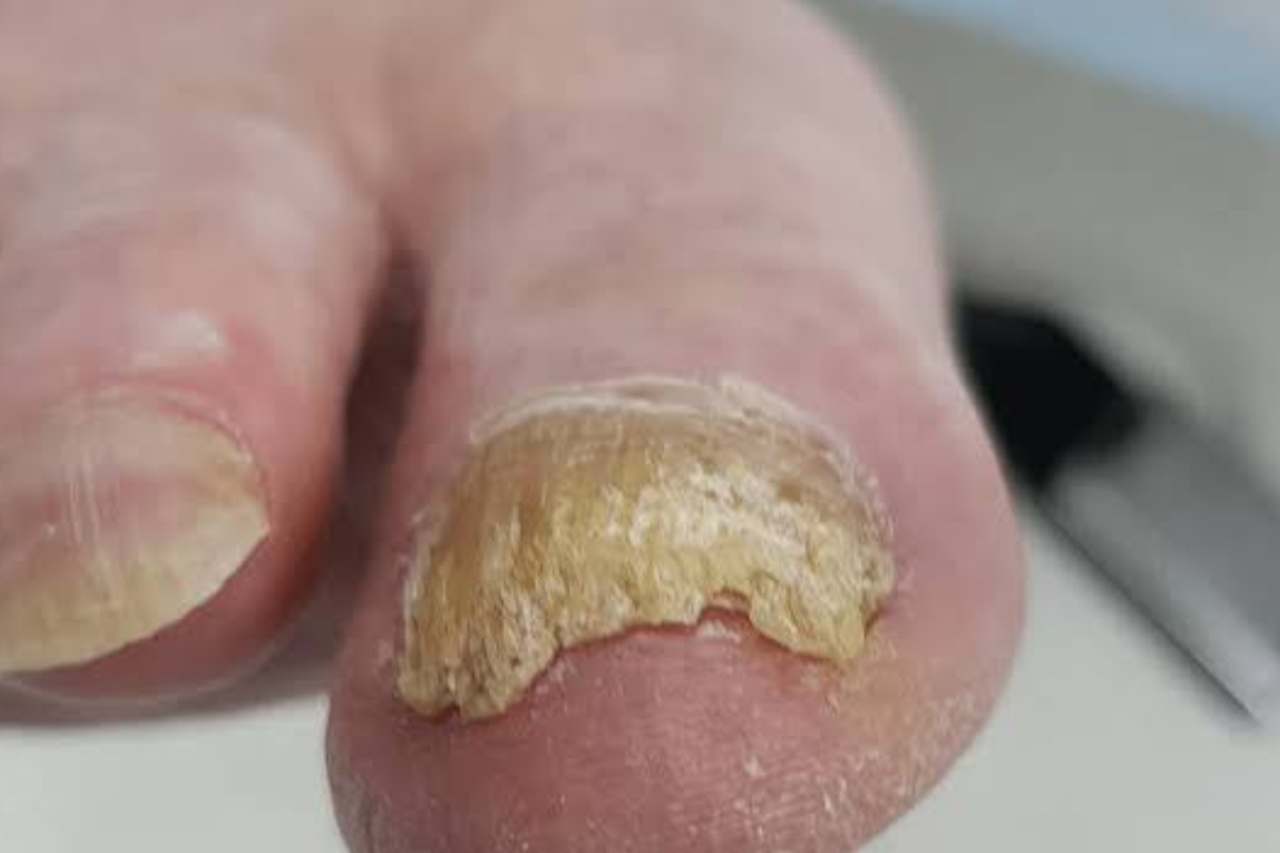 Nail and foot care