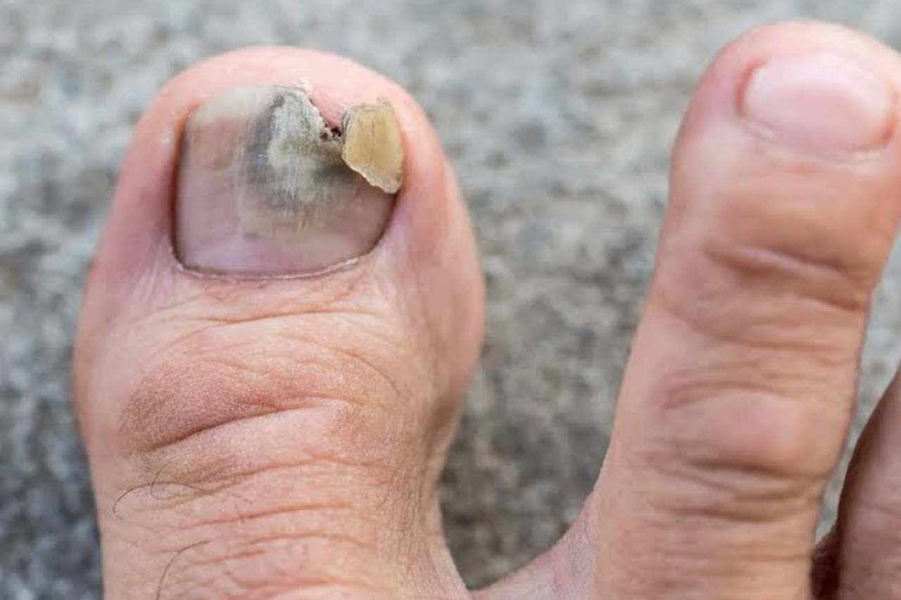 Nail and foot care
