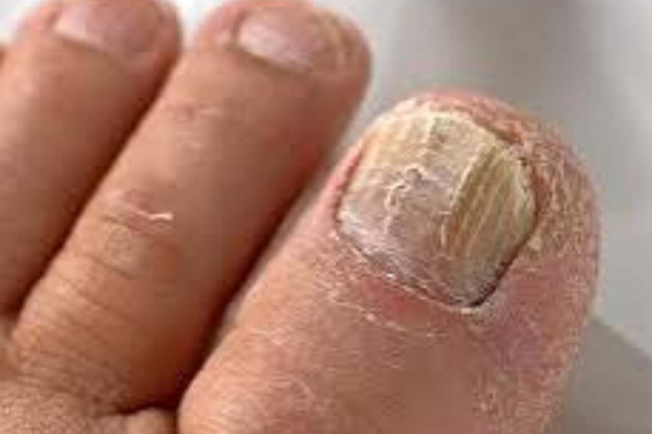 Nail and foot care