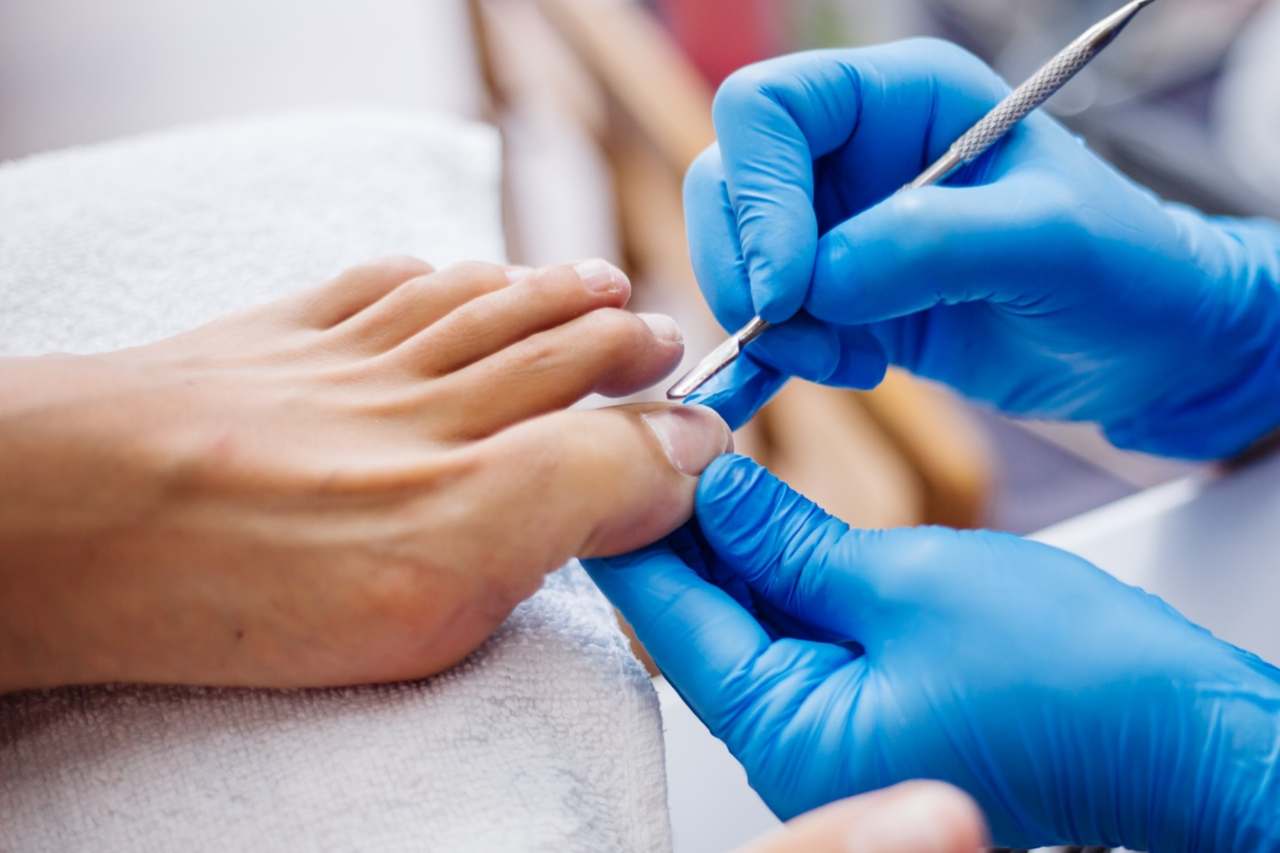 Nail and foot care
