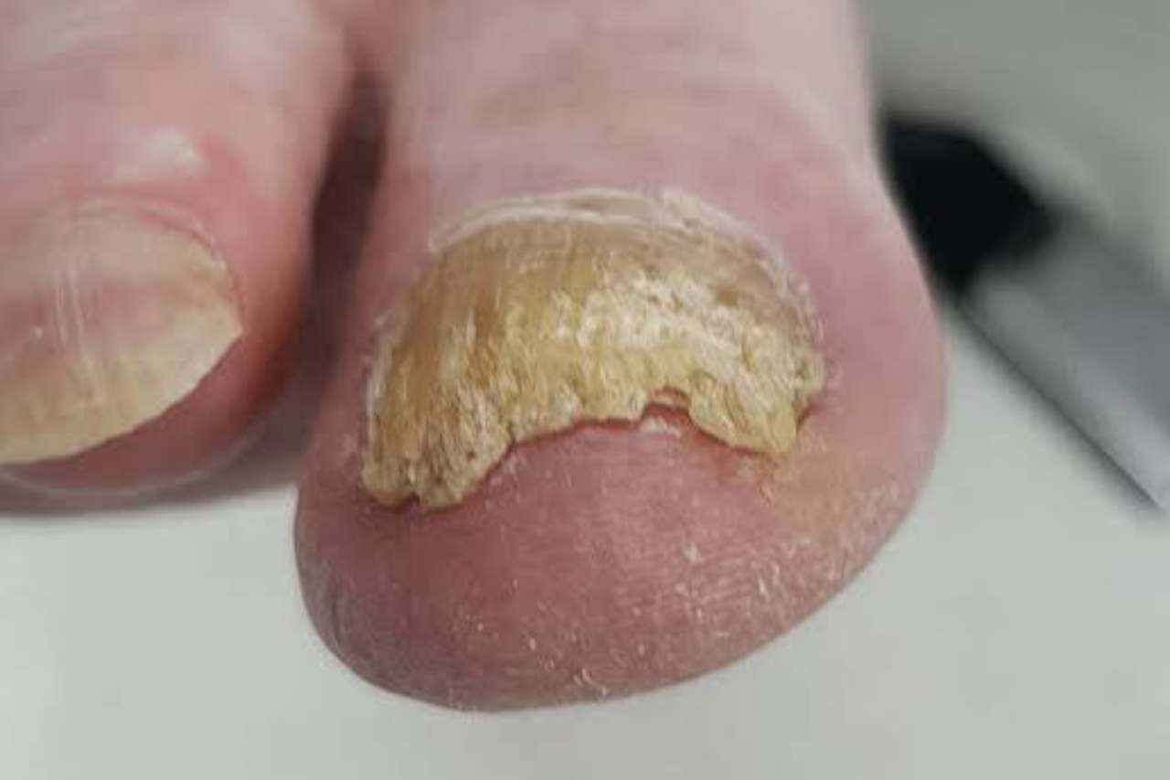 Nail and foot care