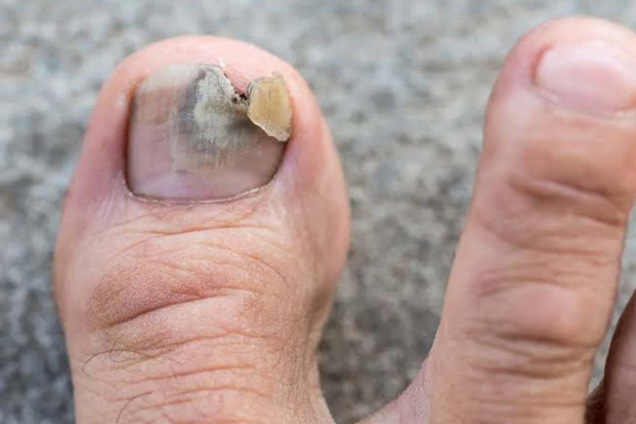 Nail and foot care