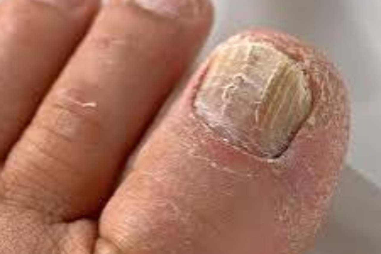 Nail and foot care