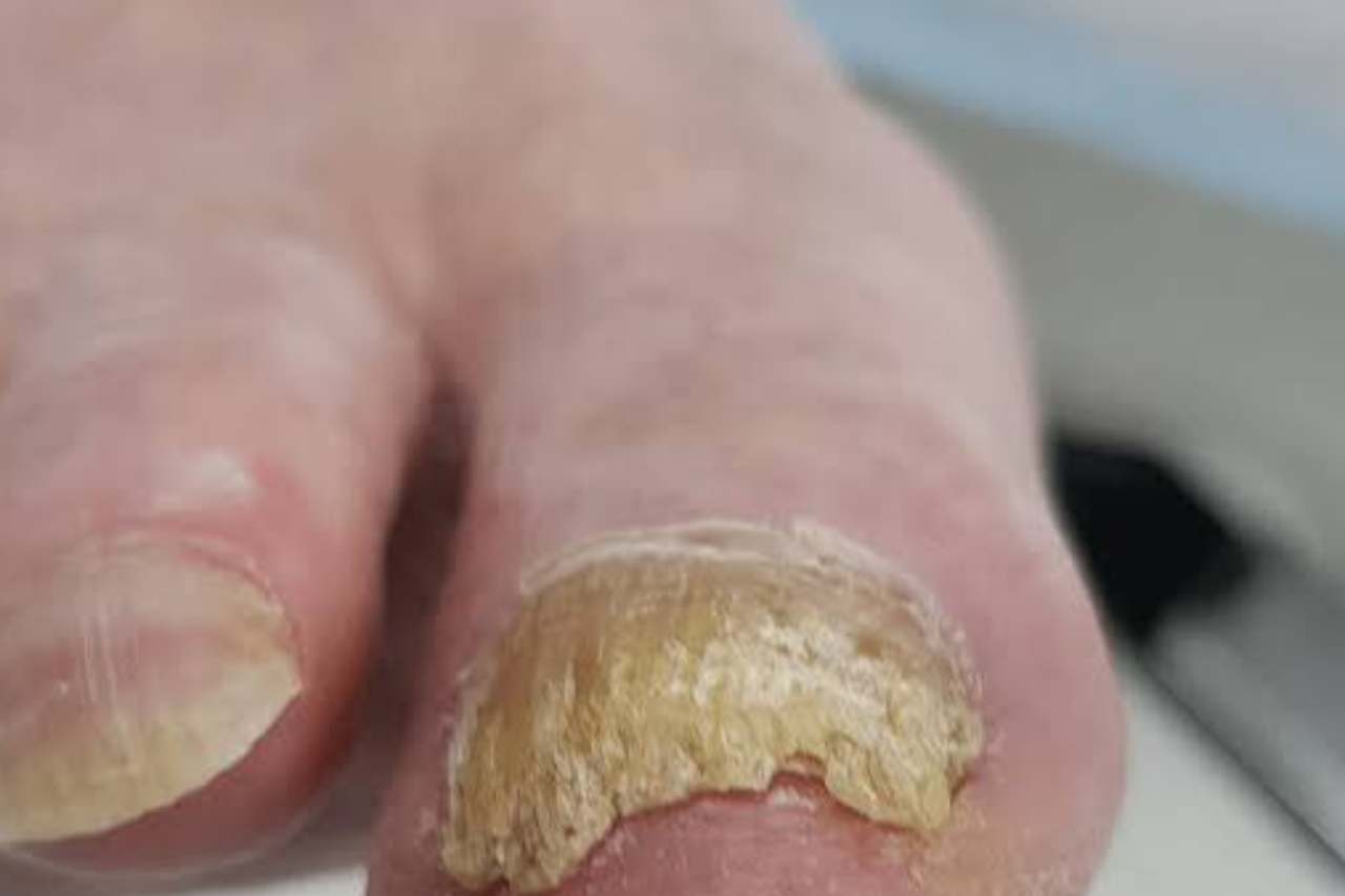 Nail and foot care