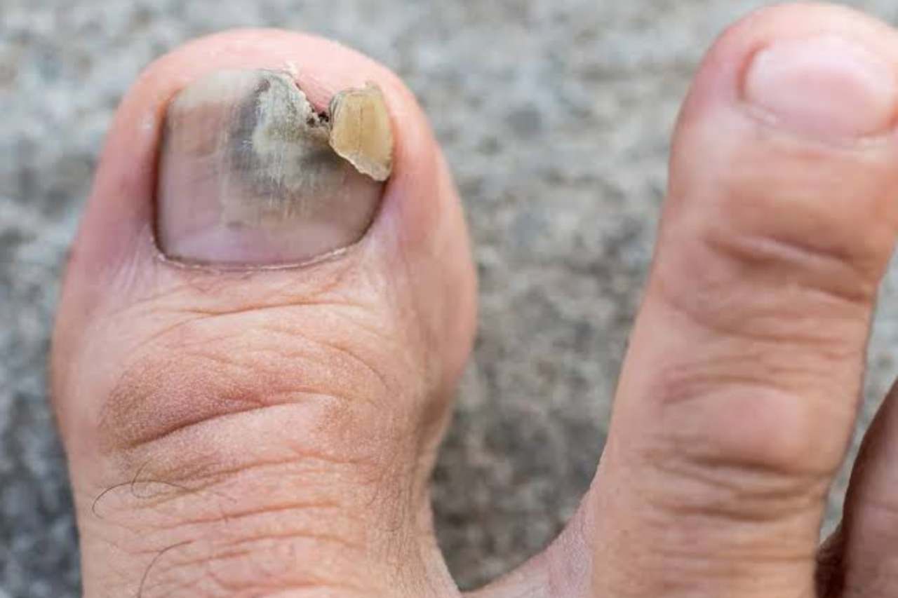 Nail and foot care