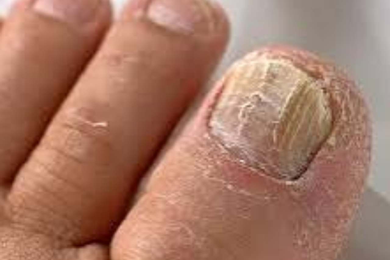 Nail and foot care