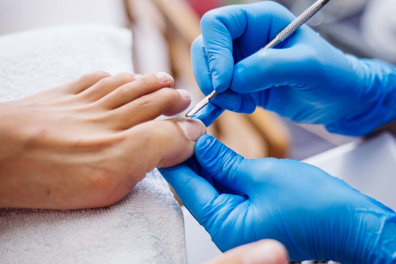 Nail and foot care