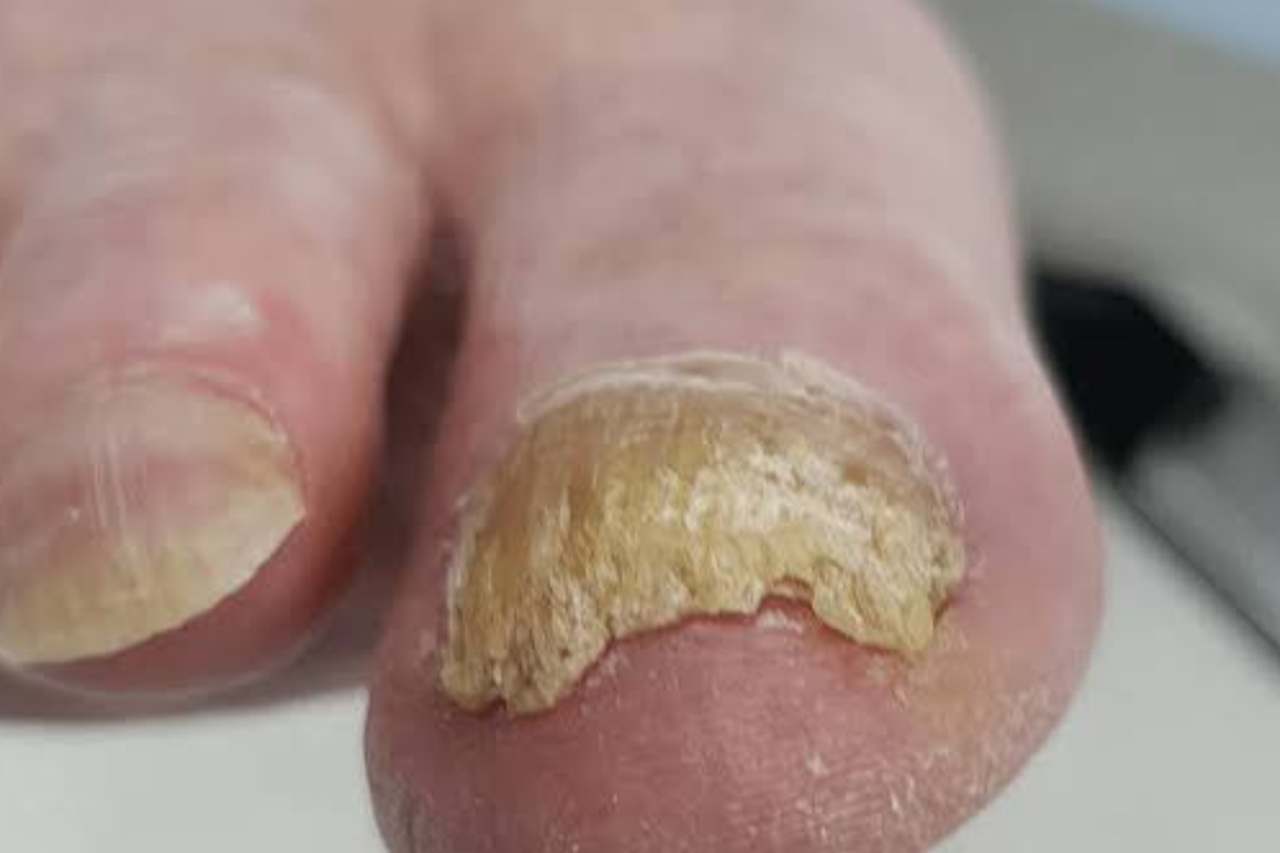 Nail and foot care