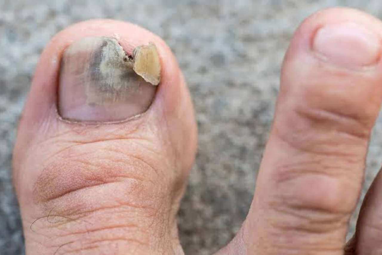 Nail and foot care