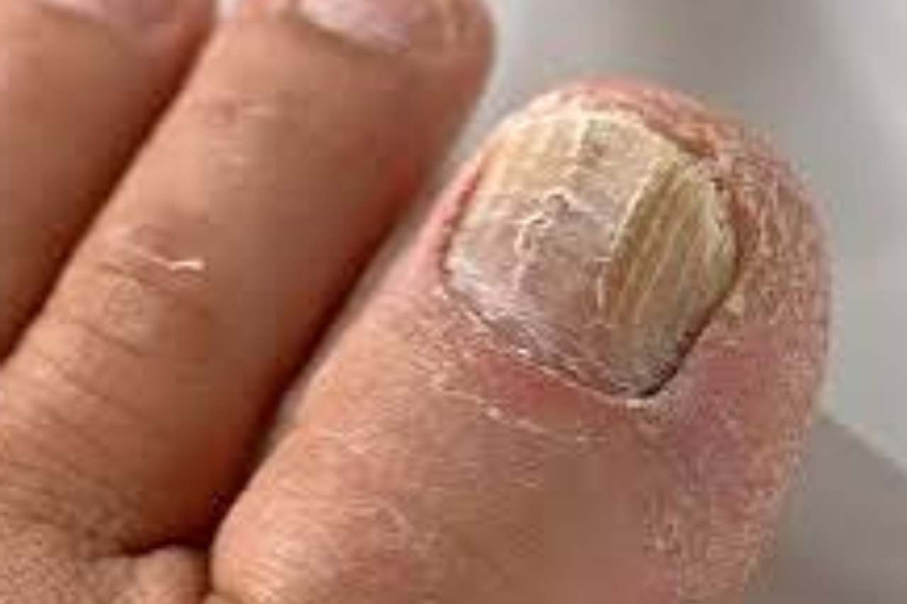 Nail and foot care