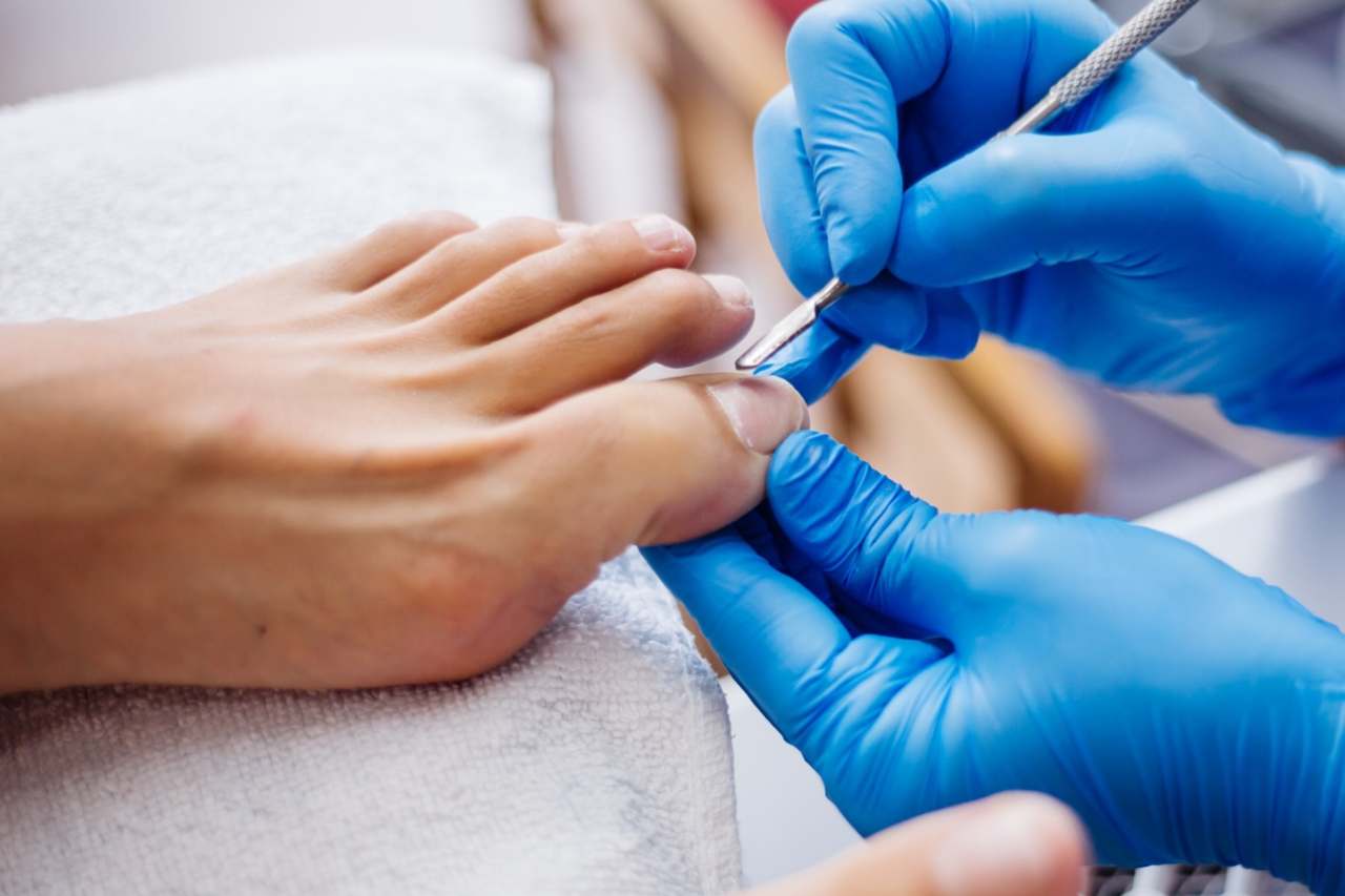 Nail and foot care
