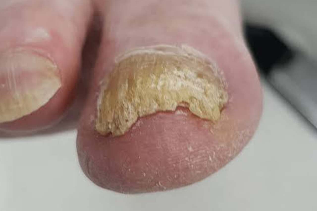 Nail and foot care