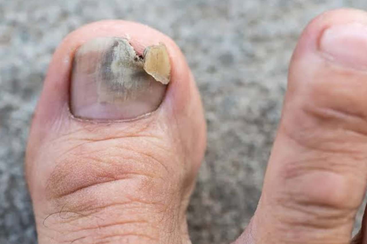 Nail and foot care