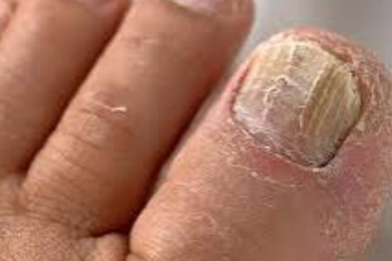 Nail and foot care