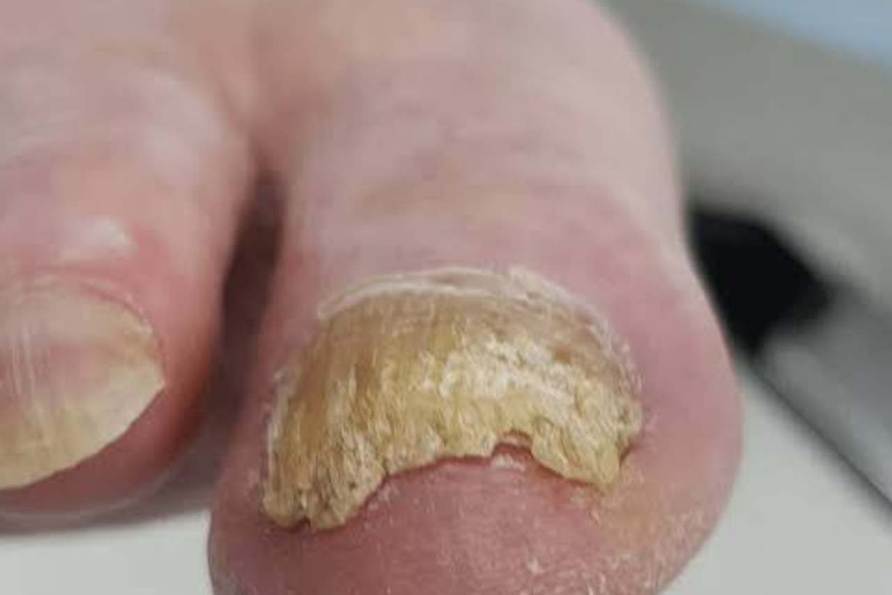 Nail and foot care
