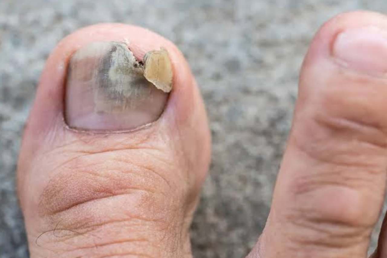 Nail and foot care