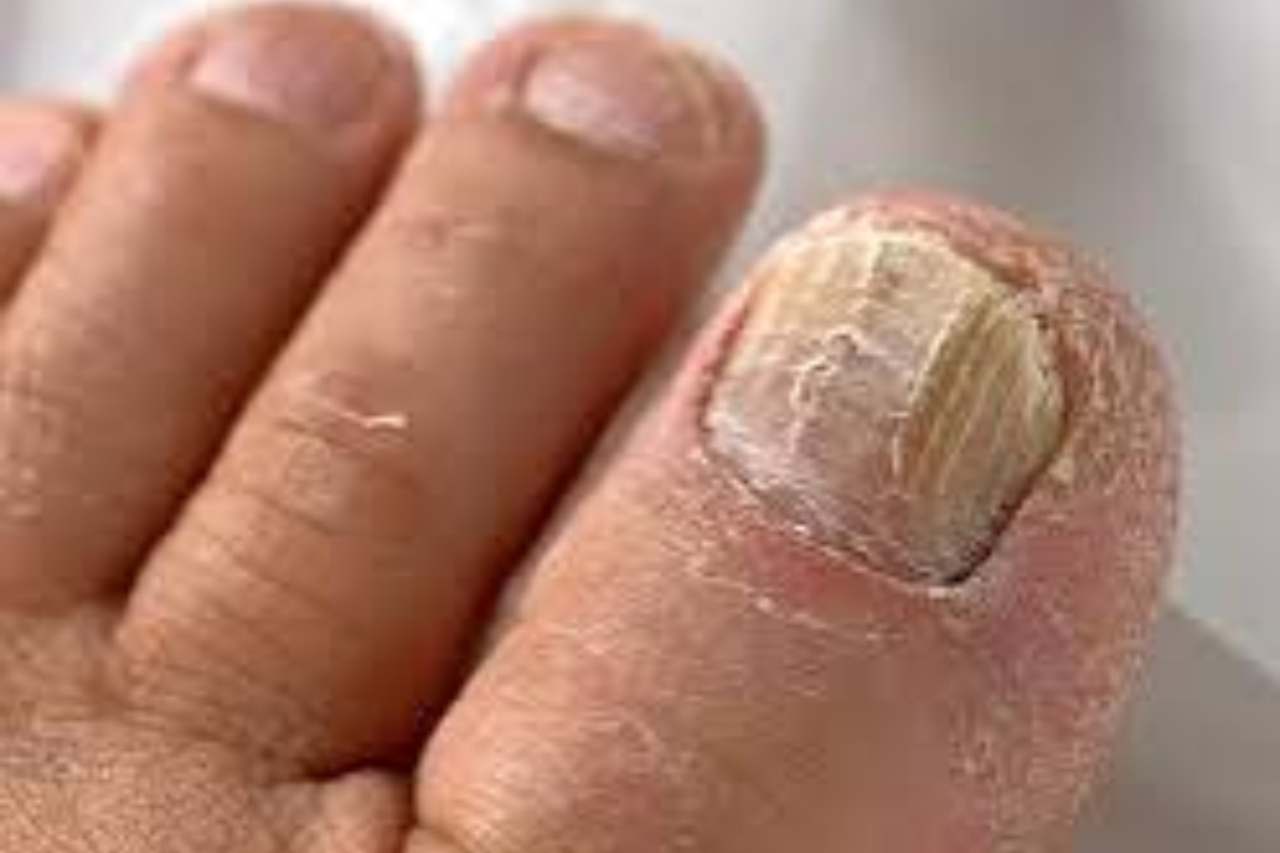Nail and foot care