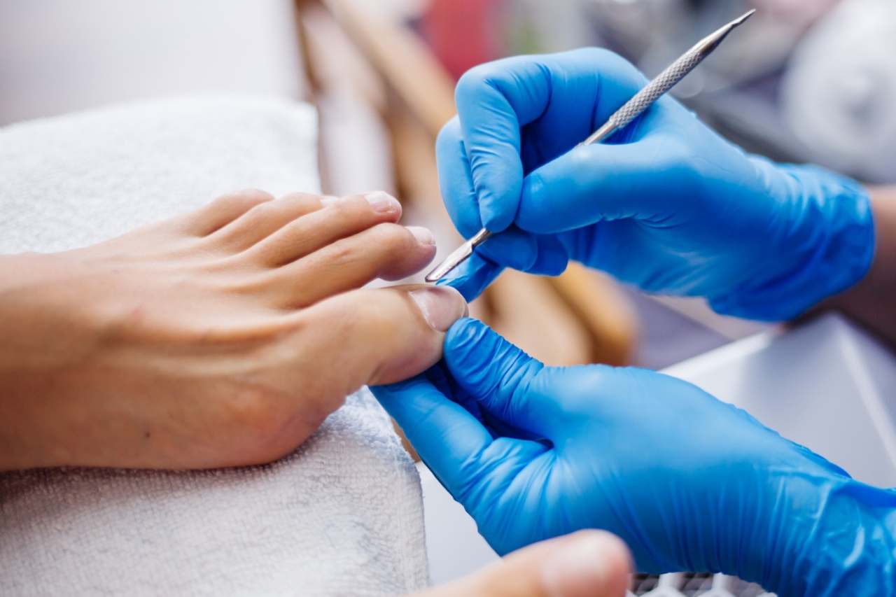 Nail and foot care