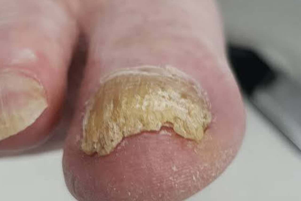 Nail and foot care