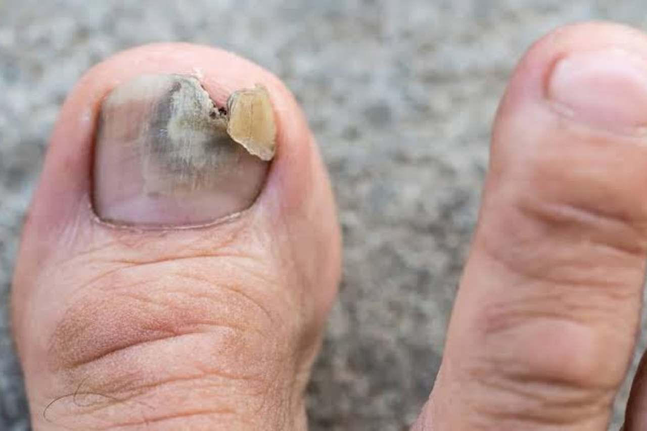 Nail and foot care