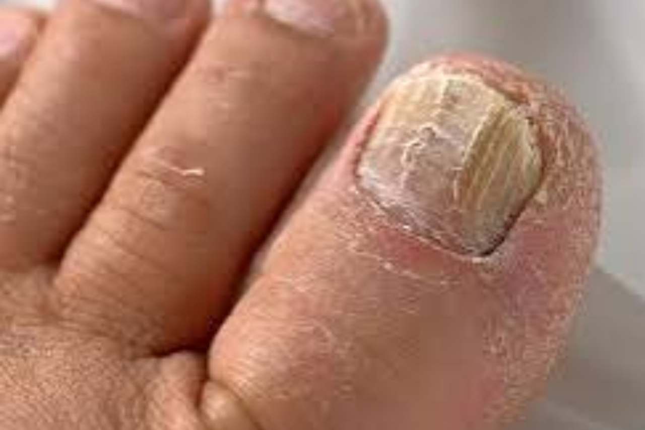 Nail and foot care