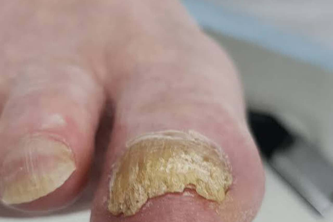Nail and foot care