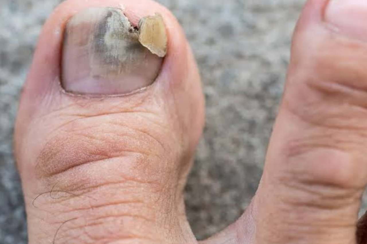 Nail and foot care