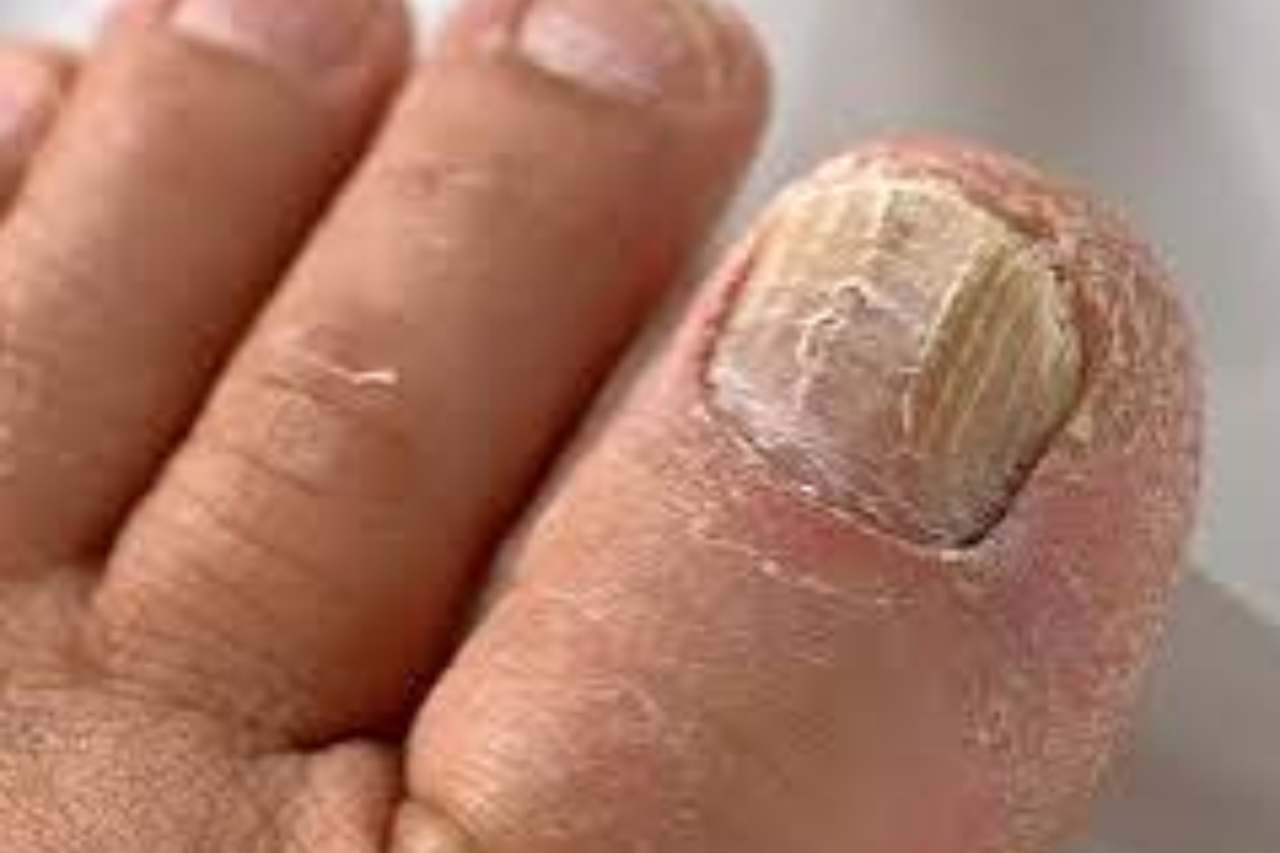 Nail and foot care