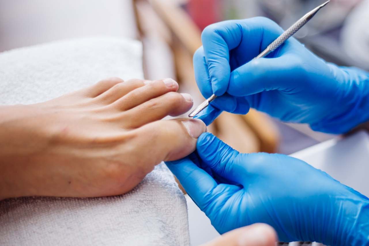 Nail and foot care
