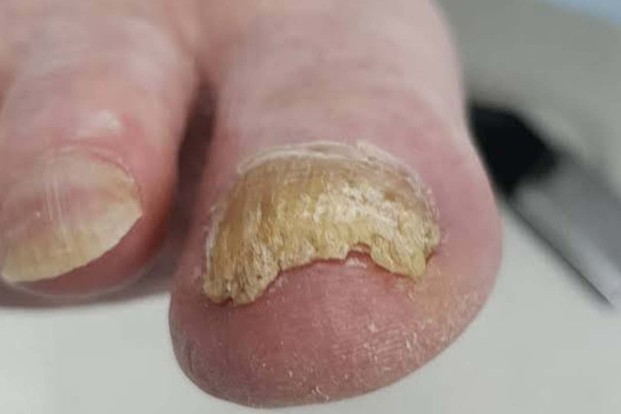 Nail and foot care