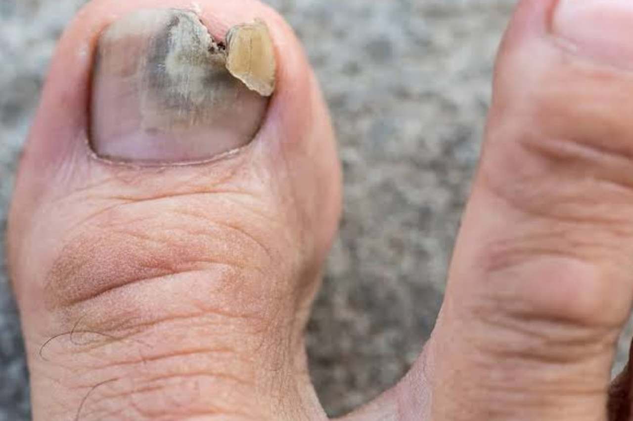 Nail and foot care