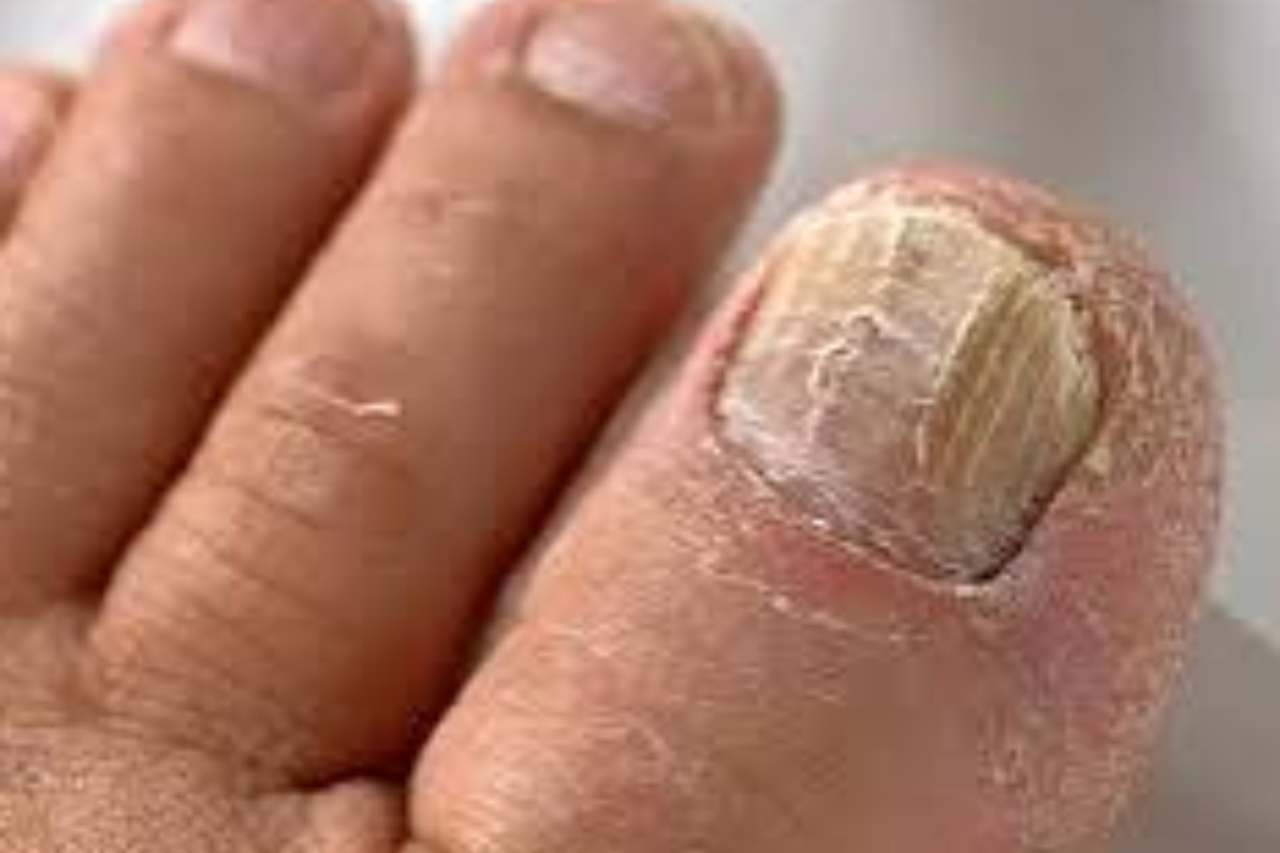 Nail and foot care