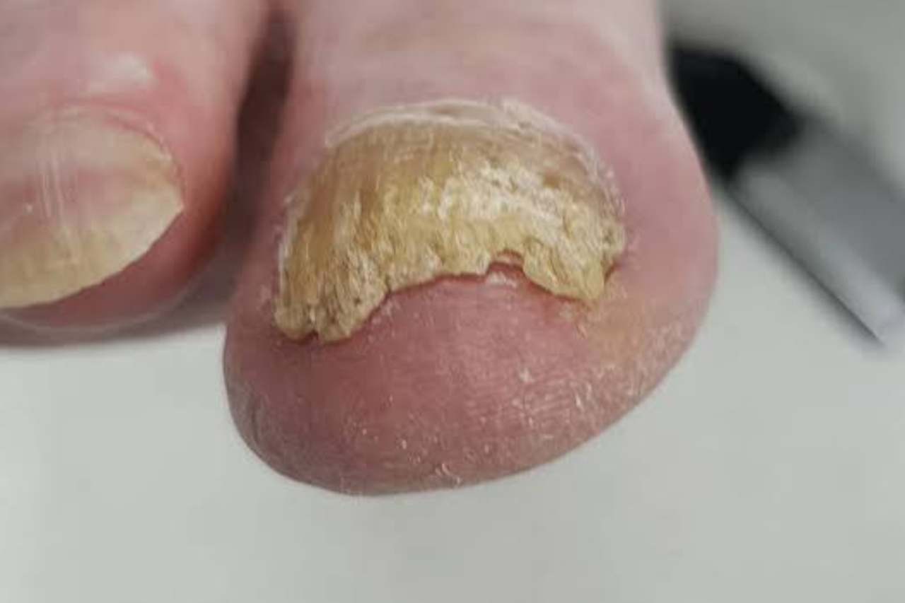Nail and foot care