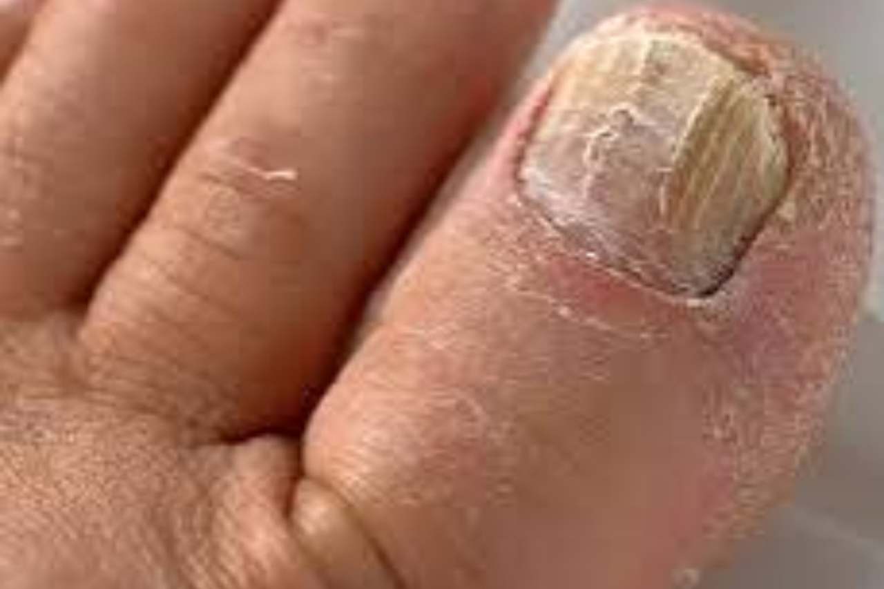 Nail and foot care