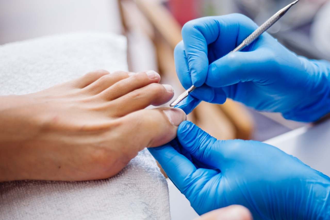 Nail and foot care