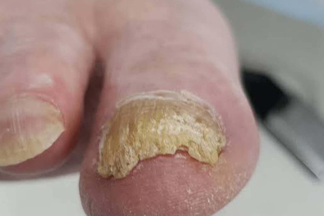 Nail and foot care