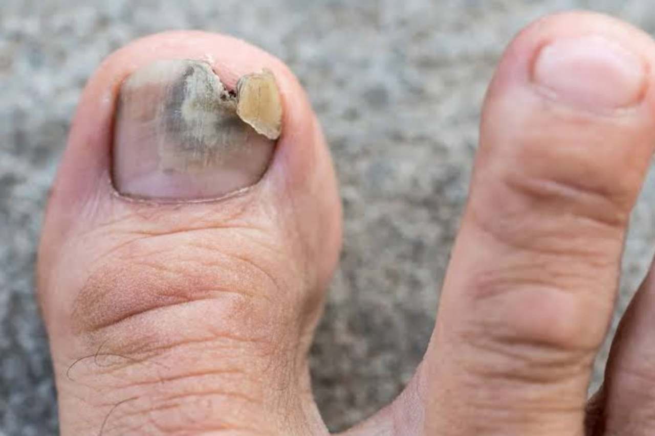 Nail and foot care