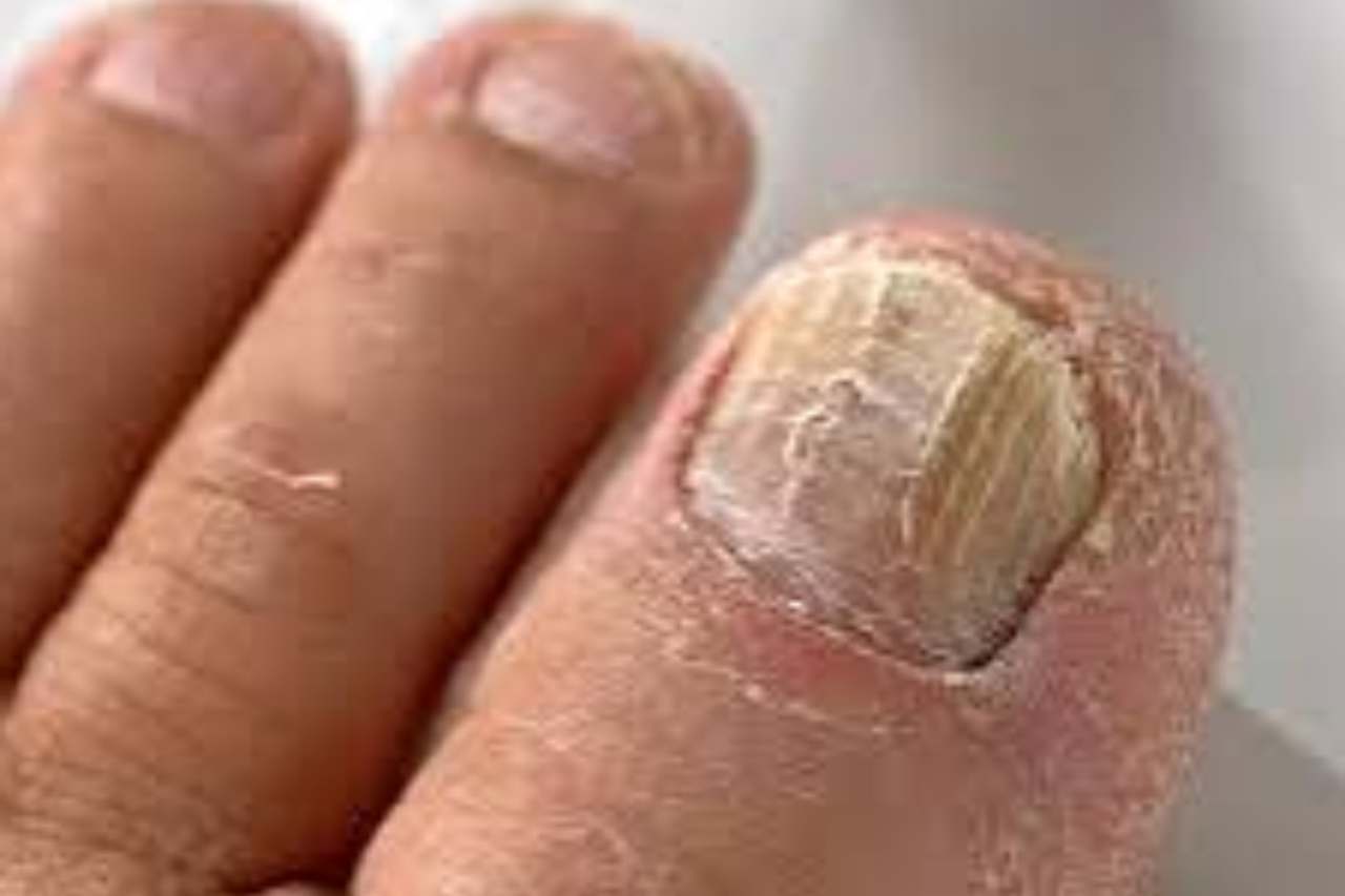 Nail and foot care