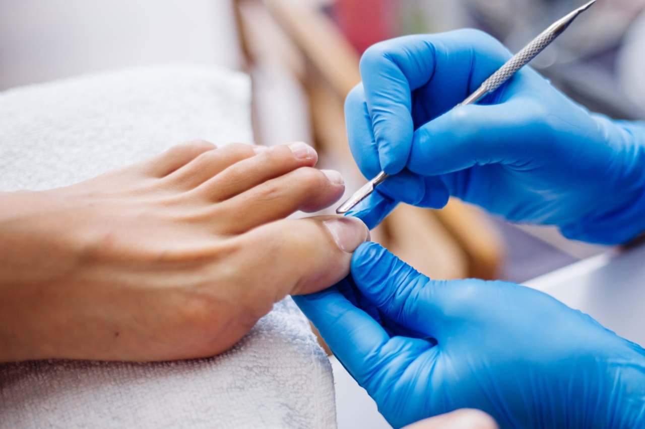 Nail and foot care