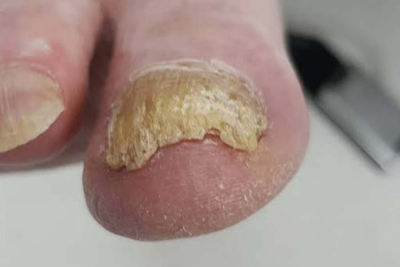 Nail and foot care
