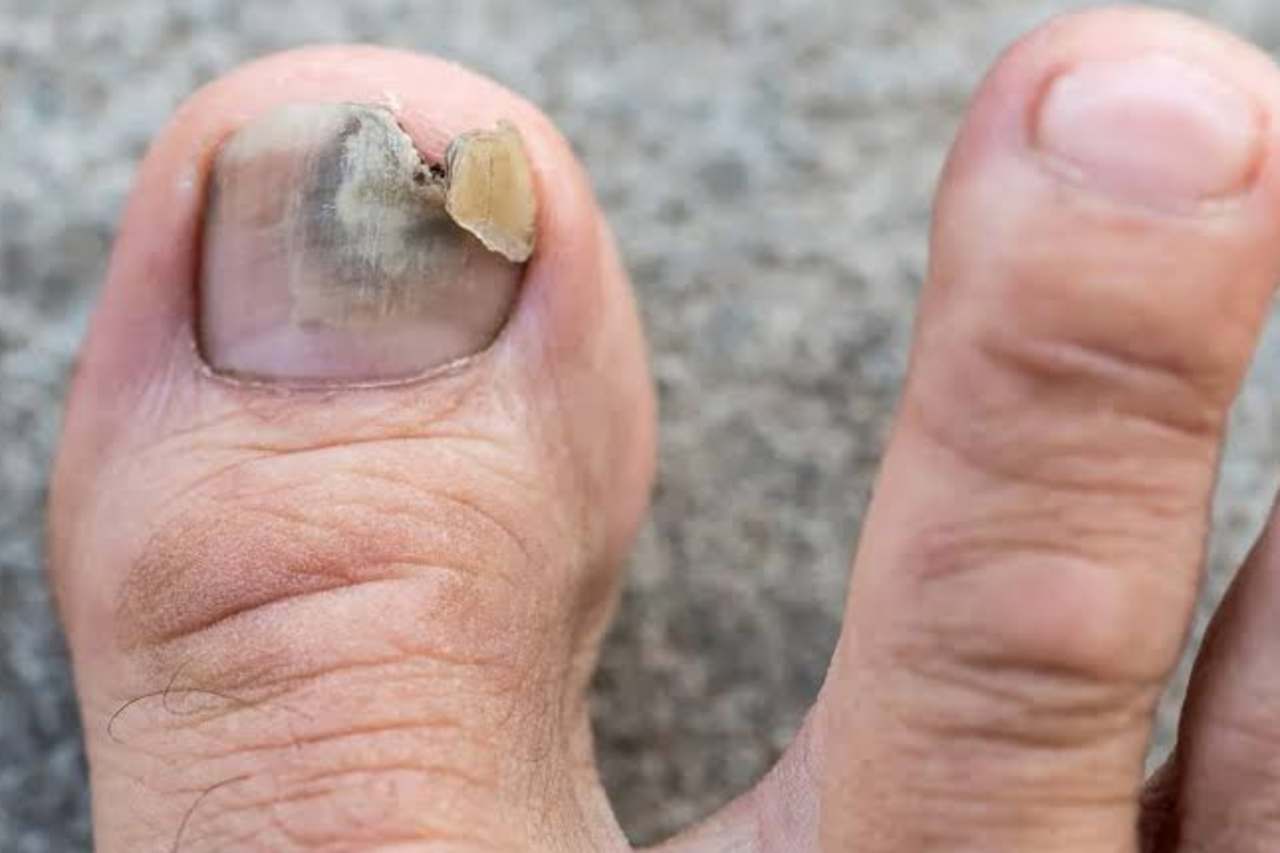 Nail and foot care