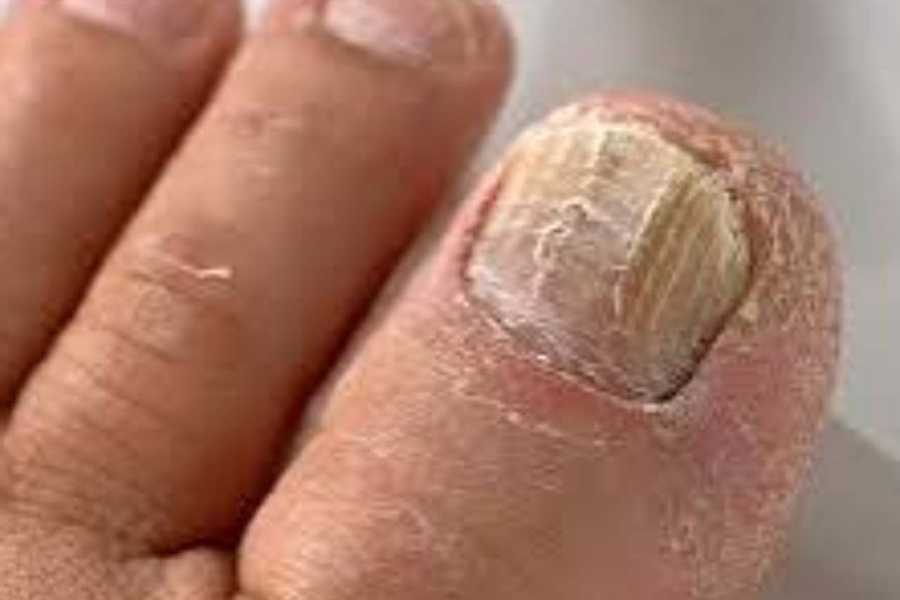 Nail and foot care