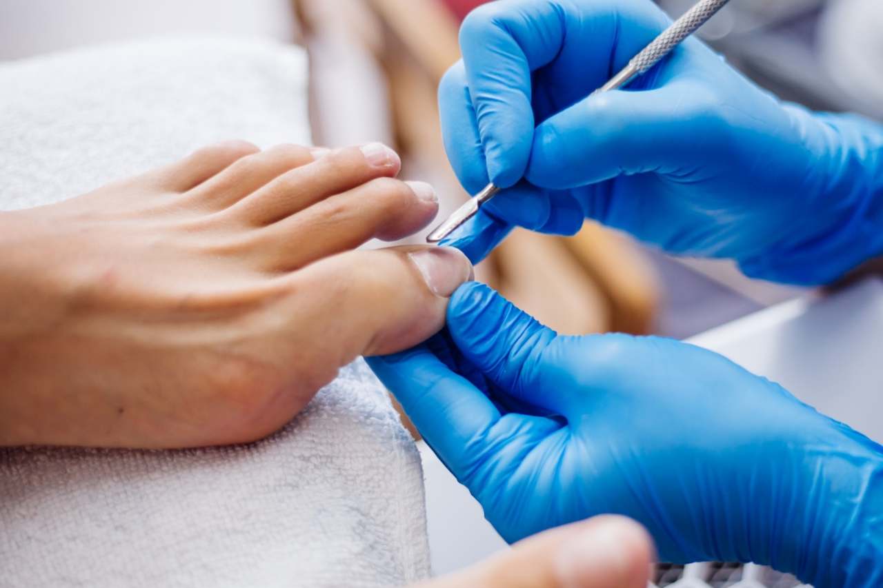 Nail and foot care
