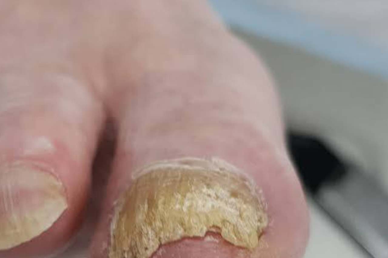 Nail and foot care