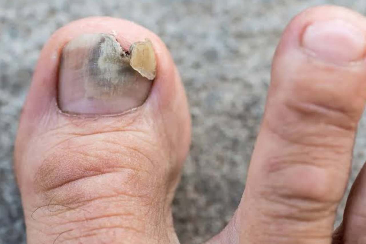 Nail and foot care