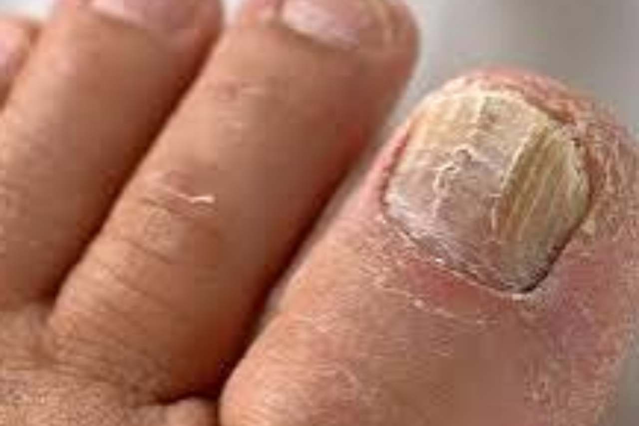 Nail and foot care
